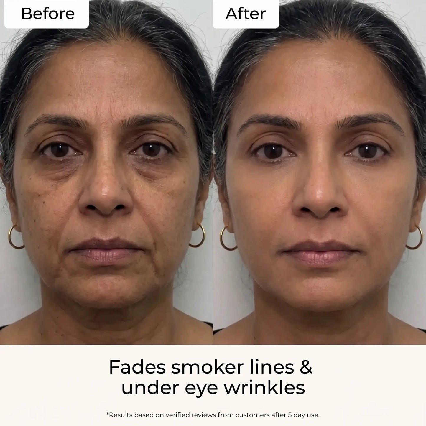 Velira Fine Line Filler