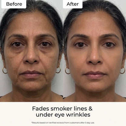 Velira Fine Line Filler