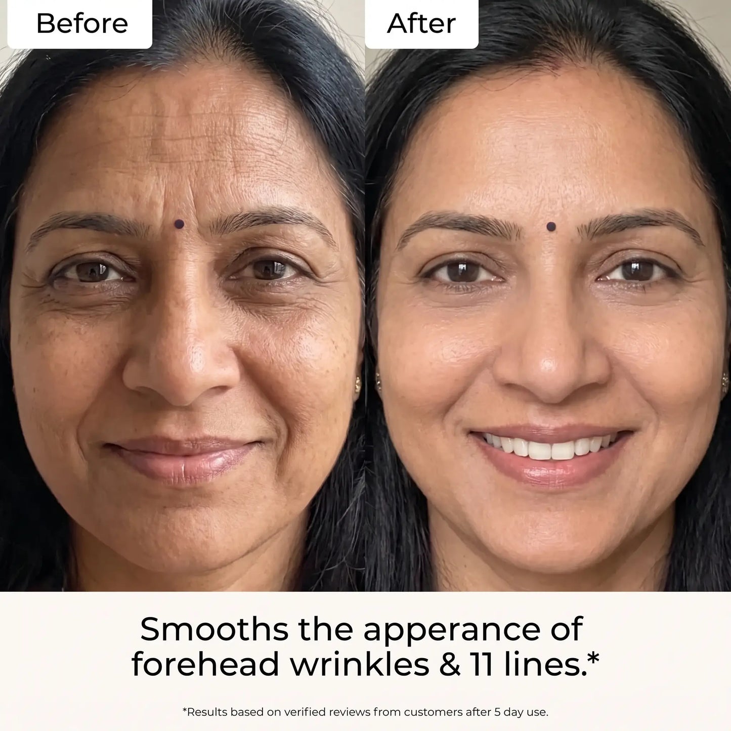 Velira Fine Line Filler